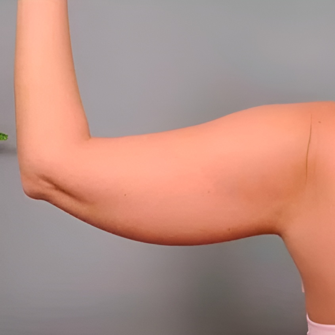 Describes the appearance of the image